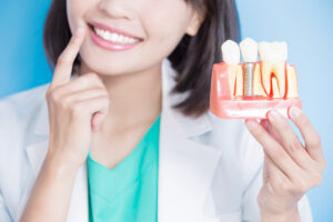 インプラントの歯の模型を持って笑う女性