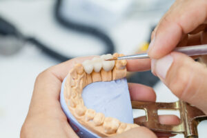 セラミックの歯を作る歯科技工士