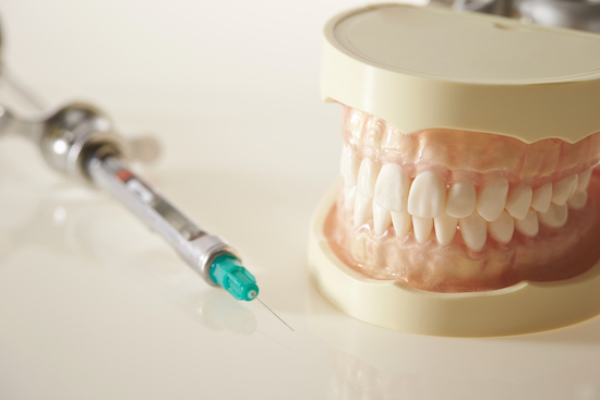 歯の模型と麻酔